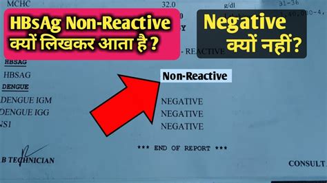 non reactive test result